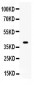 Anti-Wnt1 Picoband Antibody