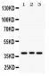 Anti-Wnt2 Picoband Antibody