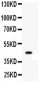 Anti-Wnt2b Picoband Antibody