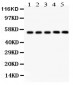 Anti-YB1 Picoband Antibody