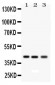 Anti-RAGE Picoband Antibody