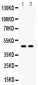 Anti-AGTR1 Picoband Antibody
