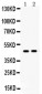 Anti-AGTR1 Picoband Antibody