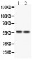 Anti-ALDH2 Picoband Antibody