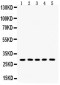 Anti-Aquaporin 1 Picoband Antibody