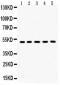 Anti-Aquaporin 2 Picoband Antibody