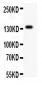 Anti-ATX2 Picoband Antibody