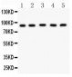 Anti-CPT1B Picoband Antibody