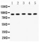 Anti-CPT1B Picoband Antibody