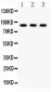 Anti-CTCF Picoband Antibody