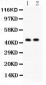 Anti-Cystathionase Picoband Antibody