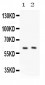 Anti-PKLR Picoband Antibody