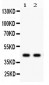 Anti-SGCA Picoband Antibody