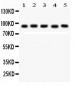 Anti-STAT5b Picoband Antibody