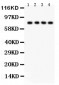 Anti-sTNFsR II Antibody