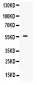 Anti-BMPR1B Picoband Antibody