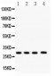 Anti-CA1 Picoband Antibody