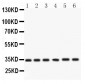 Anti-Cdk4 Picoband Antibody