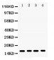 Anti-CENPA Picoband Antibody