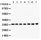 Anti-COMT Picoband Antibody