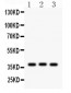 Anti-CTGF Picoband Antibody