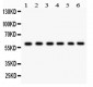 Anti-CYP24A1 Picoband Antibody