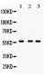 Anti-CYP27B1 Picoband Antibody