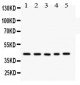 Anti-CYR61/CCN1 Antibody