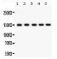 Anti-Daxx Picoband Antibody