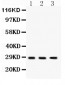 Anti-DKK2 Picoband Antibody