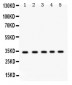 Anti-EBAG9 Picoband Antibody