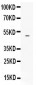 Anti-EDNRB Picoband Antibody