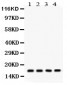 Anti-Stathmin 1 Picoband Antibody