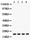 Anti-Stathmin 1 Picoband Antibody