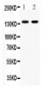 Anti-E-Cadherin Antibody