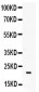 Anti-G-CSF Picoband Antibody