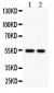 Anti-Cystatin A Picoband Antibody