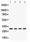 Anti-BAFF Picoband Antibody