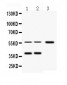 Anti-Fetuin A Antibody