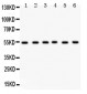 Anti-DLD Picoband Antibody