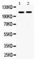 Anti-Eph Receptor A5 Picoband Antibody