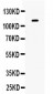 Anti-Eph Receptor B1 Picoband Antibody