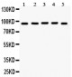 Anti-EWSR1 Picoband Antibody