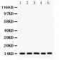 Anti-liver FABP Picoband Antibody