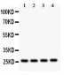 Anti-Flt-3ligand Antibody