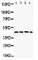 Anti-FRA2 Picoband Antibody