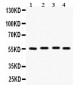 Anti-Fascin Picoband Antibody