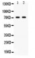 Anti-Frizzled Homolog 1 Picoband Antibody