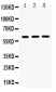 Anti-HNF1 Beta Picoband Antibody