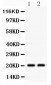 Anti-HSPB2 Picoband Antibody